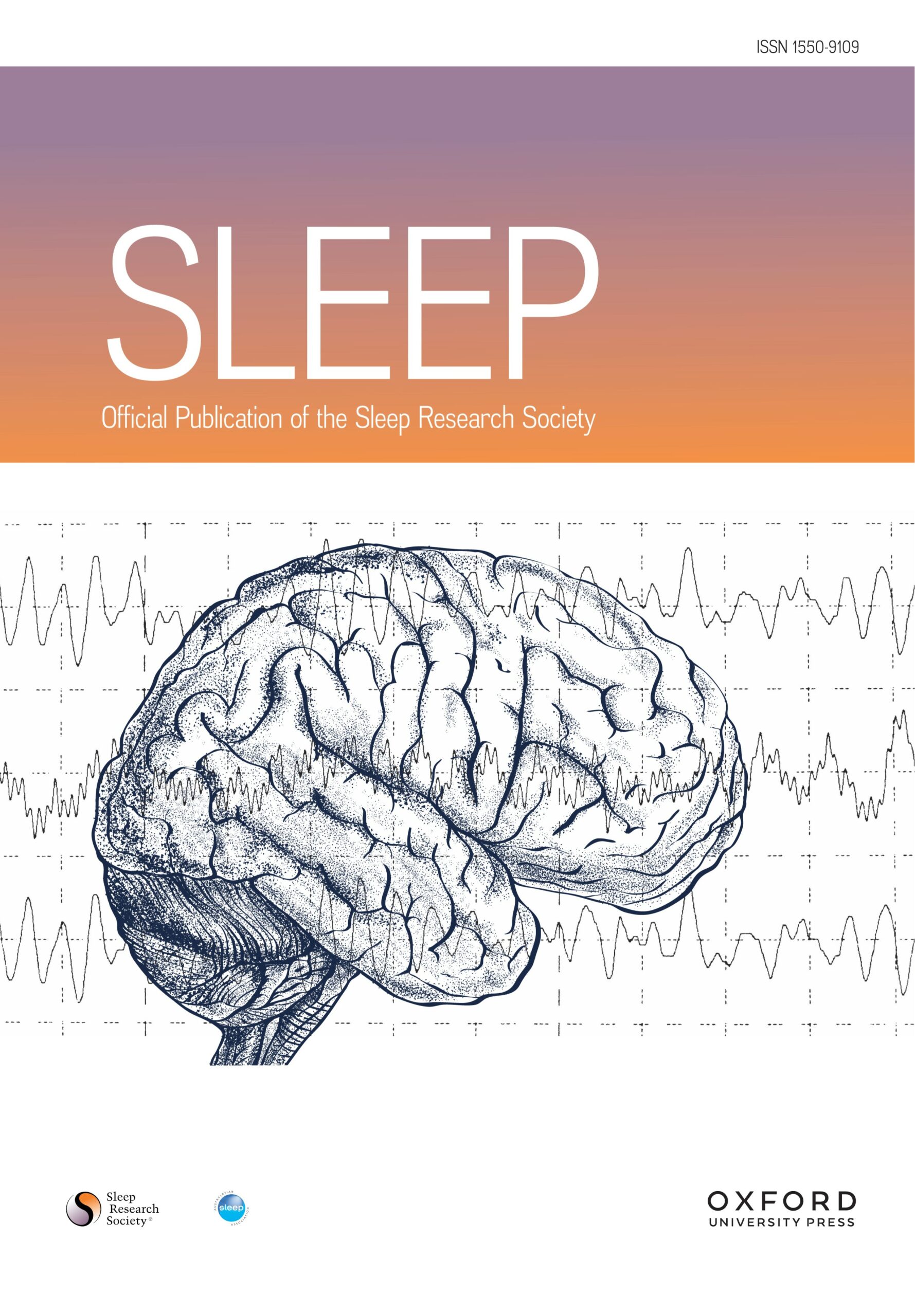 Longer sleep duration and neuroinflammation in at-risk elderly with a parental history of Alzheimer’s disease. (Baril AA. et al., 2024)